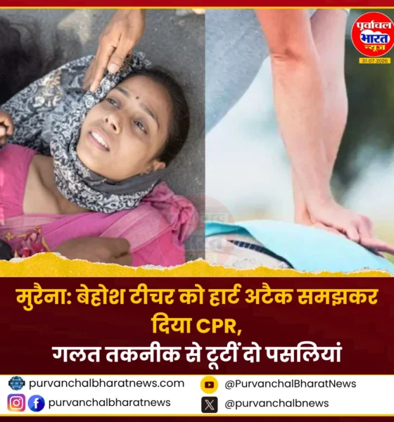 मुरैना में बेहोश महिला टीचर को गलत CPR देने की सांकेतिक तस्वीर
